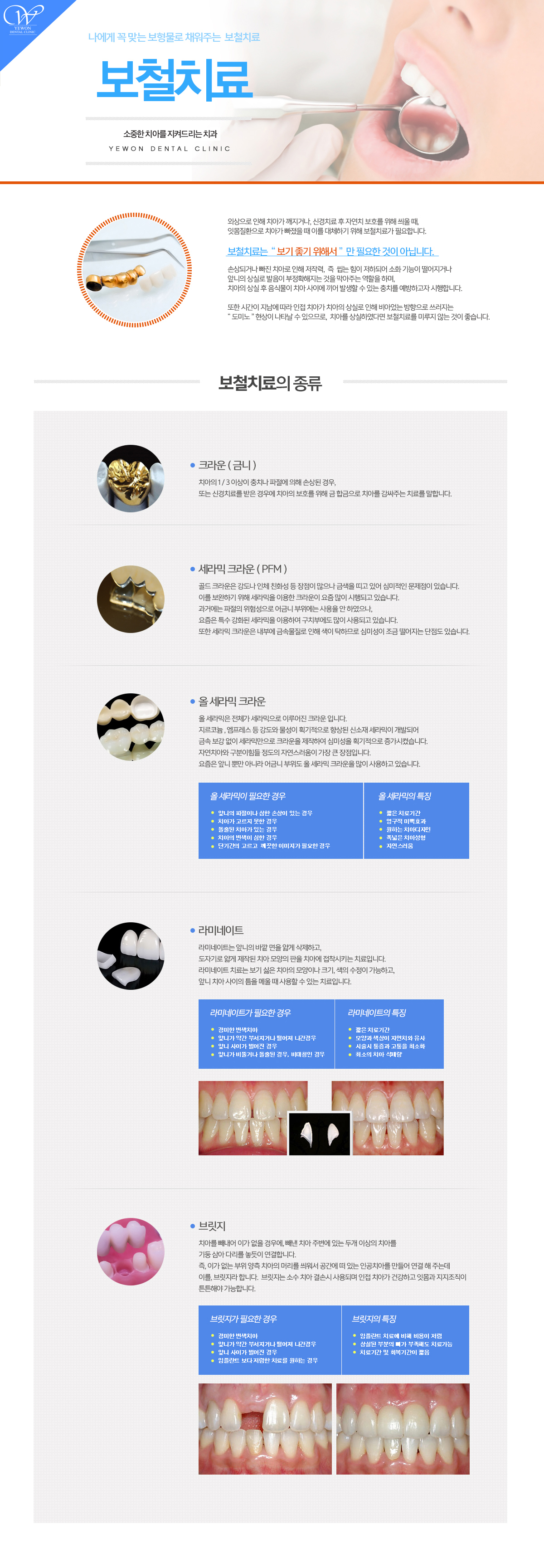 보철치료